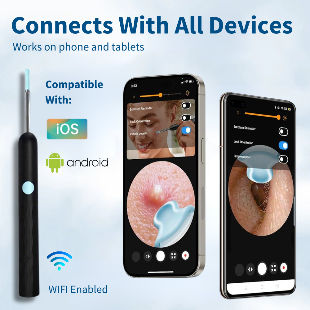 👂Owiwell®Smart Visual Ear Cleaner-🛡️No More Blind Digging