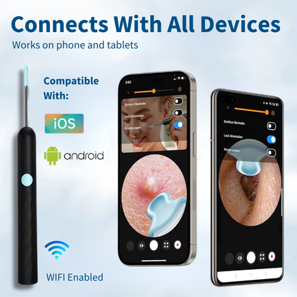 👂Owiwell®Smart Visual Ear Cleaner-🛡️No More Blind Digging