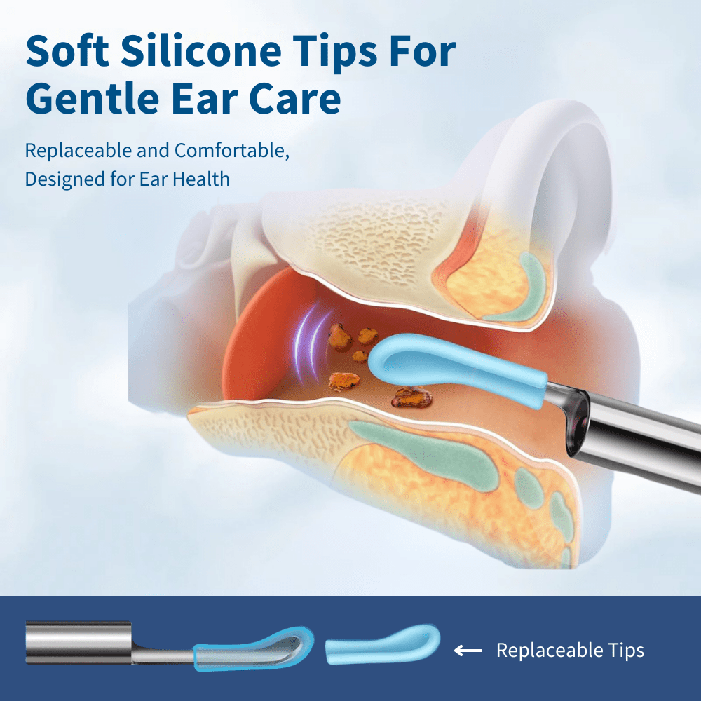 👂Owiwell®Smart Visual Ear Cleaner-🛡️No More Blind Digging