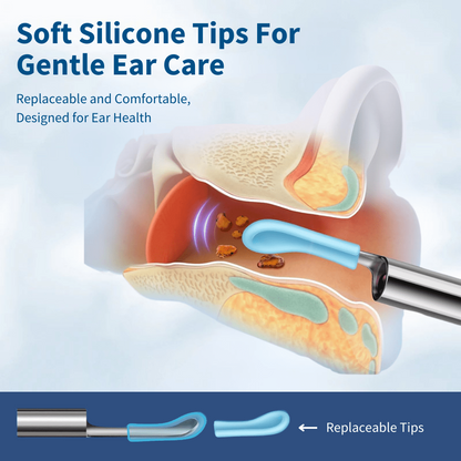 👂Owiwell®Smart Visual Ear Cleaner-🛡️No More Blind Digging