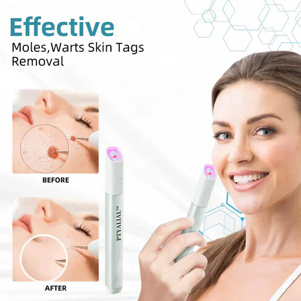 ✨Cavebit™ All-in-One CO₂ Laser Eraser Pen | Removes Moles, Warts, Skin Flaws & Pigmentation