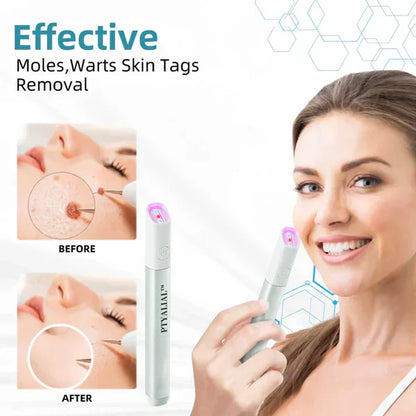 ✨Cavebit™ All-in-One CO₂ Laser Eraser Pen | Removes Moles, Warts, Skin Flaws & Pigmentation