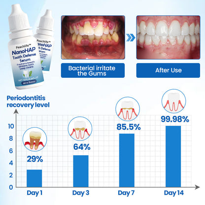Peachlife™ NanoHAP Tooth Defense Serum | Enamel Repair & Sensitivity Relief