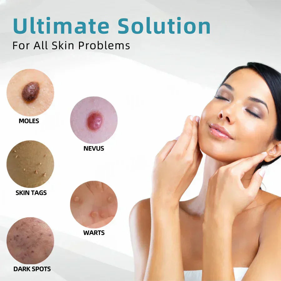✨Cavebit™ All-in-One CO₂ Laser Eraser Pen | Removes Moles, Warts, Skin Flaws & Pigmentation