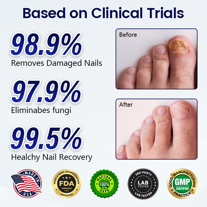 Acezozla® Anti-Fungal Nail Repair Patch