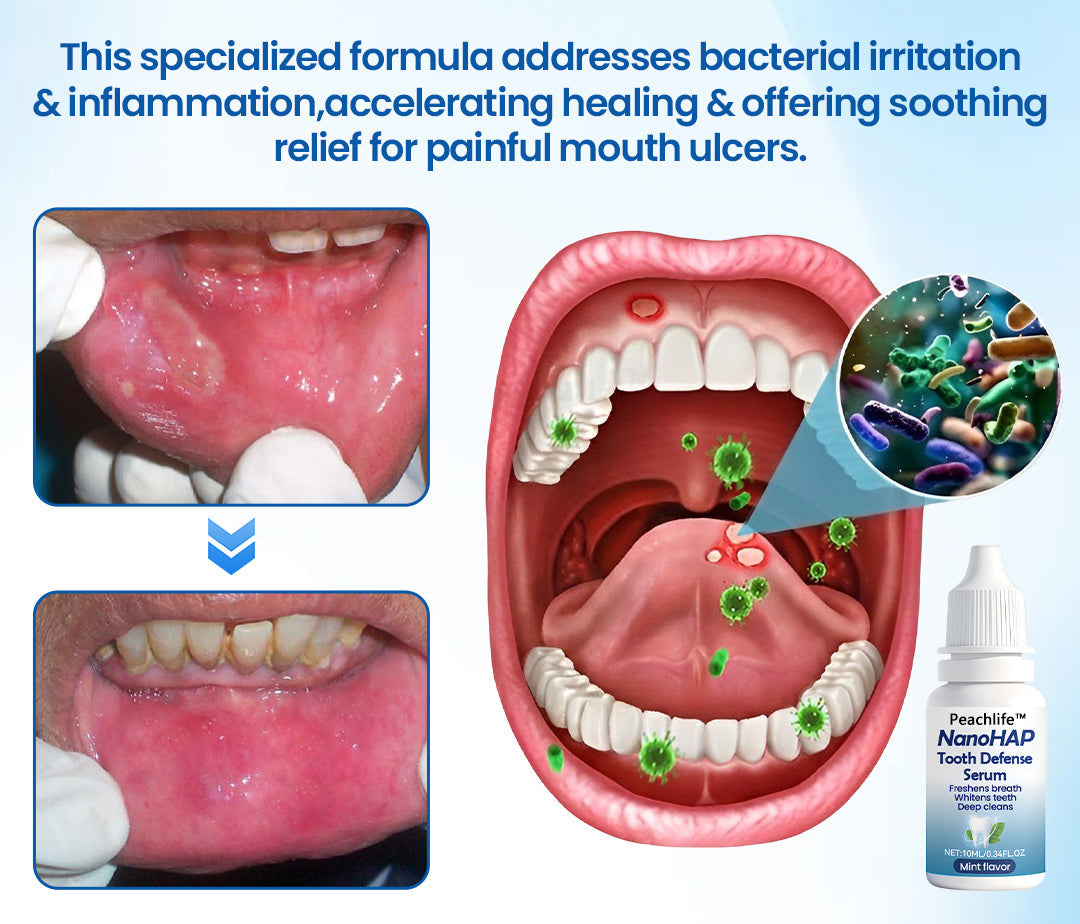 Peachlife™ NanoHAP Tooth Defense Serum | Enamel Repair & Sensitivity Relief