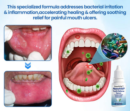Peachlife™ NanoHAP Tooth Defense Serum | Enamel Repair & Sensitivity Relief