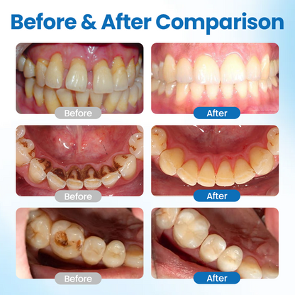 Peachlife™ NanoHAP Tooth Defense Serum | Enamel Repair & Sensitivity Relief