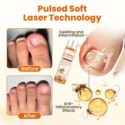 Acezozla® FungiBee Advanced Nail Repair Spray